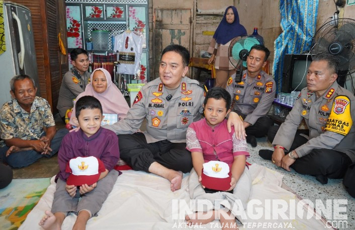 Dibiayai Jenderal Bintang 2, Adik-Kakak Penderita Tulang Kaca di Pekanbaru Berangsur Pulih